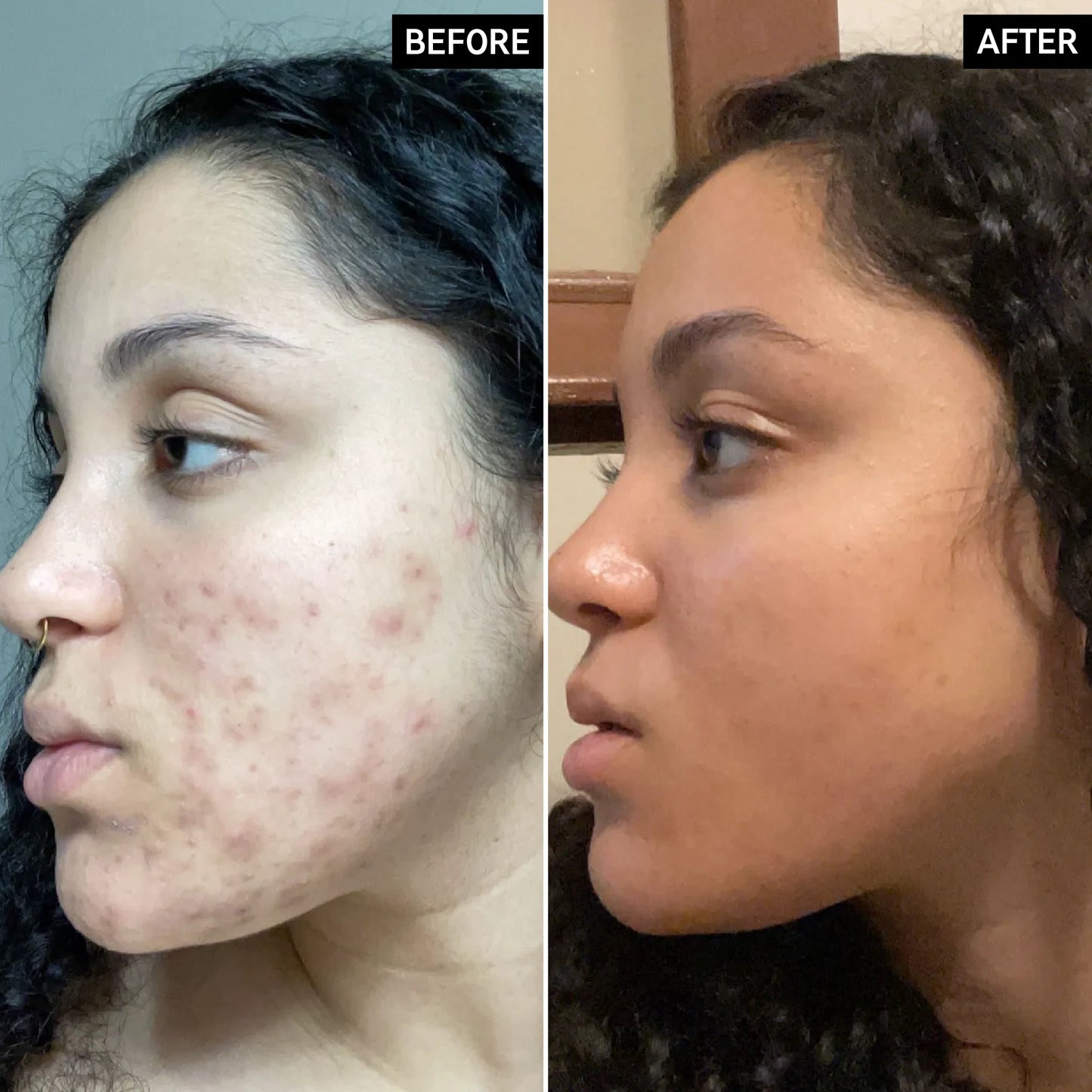 The Inkey List - TRANEXAMIC ACID SERUM